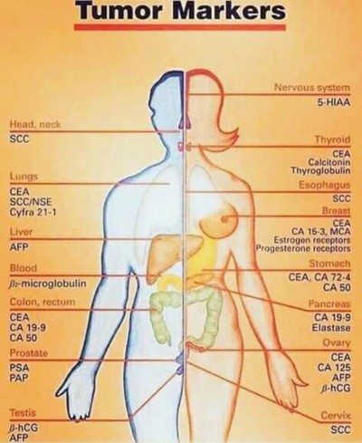 Body organs liable to developing cancer and their respective markers to ease identification of cancer type by lab scientists